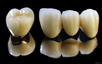 Răng thép sứ